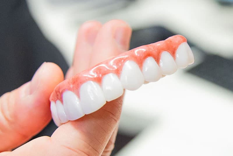 Full Fixed Set of Teeth